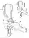Fig. 06 - Prostheses and methods for acetabular rim restoration in quadruped mammals