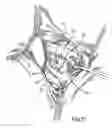 Fig. 10 - Prostheses and methods for acetabular rim restoration in quadruped mammals