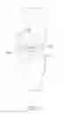 Fig. 03 - KNEE REPLACEMENT SYSTEM AND METHOD FOR ENABLING NATURAL KNEE MOVEMENT