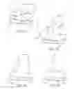 Fig. 07 - KNEE REPLACEMENT SYSTEM AND METHOD FOR ENABLING NATURAL KNEE MOVEMENT