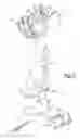 Fig. 03 - Knee prosthesis systems and methods