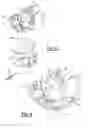 Fig. 04 - Knee prosthesis systems and methods