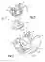 Fig. 06 - Knee prosthesis systems and methods