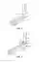 Fig. 02 - TALAR DOME FIXATION STEM