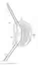 Fig. 04 - Nuclear implant apparatus and method following partial nuclectomy