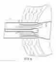 Fig. 10 - Nuclear implant apparatus and method following partial nuclectomy