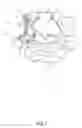 Fig. 12 - SPINAL FACET IMPLANTS WITH MATING ARTICULATING BEARING SURFACE AND METHODS OF USE