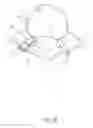 Fig. 15 - SPINAL FACET IMPLANTS WITH MATING ARTICULATING BEARING SURFACE AND METHODS OF USE
