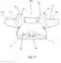 Fig. 18 - SPINAL FACET IMPLANTS WITH MATING ARTICULATING BEARING SURFACE AND METHODS OF USE