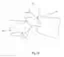 Fig. 19 - SPINAL FACET IMPLANTS WITH MATING ARTICULATING BEARING SURFACE AND METHODS OF USE