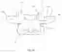 Fig. 20 - SPINAL FACET IMPLANTS WITH MATING ARTICULATING BEARING SURFACE AND METHODS OF USE