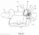 Fig. 23 - SPINAL FACET IMPLANTS WITH MATING ARTICULATING BEARING SURFACE AND METHODS OF USE