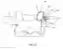 Fig. 24 - SPINAL FACET IMPLANTS WITH MATING ARTICULATING BEARING SURFACE AND METHODS OF USE