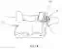 Fig. 25 - SPINAL FACET IMPLANTS WITH MATING ARTICULATING BEARING SURFACE AND METHODS OF USE