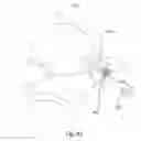 Fig. 44 - SPINAL FACET IMPLANTS WITH MATING ARTICULATING BEARING SURFACE AND METHODS OF USE
