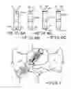 Fig. 05 - Minimally invasive collapsible cage