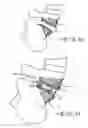 Fig. 07 - Minimally invasive collapsible cage