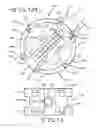 Fig. 08 - Minimally invasive collapsible cage