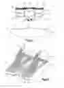 Fig. 05 - Distractible intervertebral implant