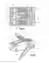 Fig. 08 - Distractible intervertebral implant