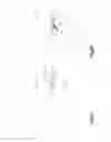 Fig. 09 - Distractible intervertebral implant