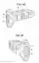 Fig. 04 - Lateral spondylolisthesis reduction cage
