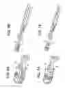 Fig. 06 - Lateral spondylolisthesis reduction cage