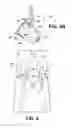 Fig. 05 - Methods and instruments for use in minimally invasive hip surgery