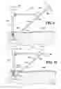 Fig. 09 - Methods and instruments for use in minimally invasive hip surgery