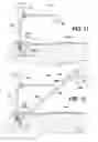 Fig. 10 - Methods and instruments for use in minimally invasive hip surgery