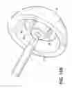 Fig. 13 - Methods and instruments for use in minimally invasive hip surgery