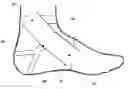 Fig. 01 - Torque generating pouch and related methods