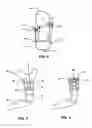 Fig. 06 - MODULAR PROSTHETIC SOCKETS AND METHODS FOR MAKING SAME
