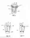 Fig. 07 - MODULAR PROSTHETIC SOCKETS AND METHODS FOR MAKING SAME
