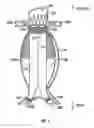 Fig. 02 - DEVICES AND METHODS FOR TREATMENT OF ABDOMINAL AORTIC ANEURYSM