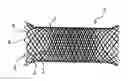 Fig. 01 - STENT