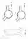 Fig. 03 - Apparatus and method of placement of a graft or graft system