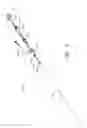 Fig. 07 - Apparatus and method of placement of a graft or graft system