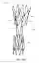 Fig. 23 - Apparatus and method of placement of a graft or graft system