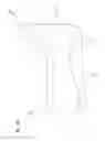 Fig. 14 - Heel float therapeutic footwear