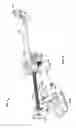 Fig. 09 - Cervical Traction System and Method