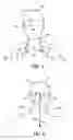 Fig. 02 - DEVICES AND METHODS FOR SUPPORTING THE HEAD AND NECK