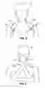 Fig. 04 - DEVICES AND METHODS FOR SUPPORTING THE HEAD AND NECK