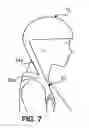 Fig. 05 - DEVICES AND METHODS FOR SUPPORTING THE HEAD AND NECK