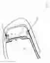 Fig. 04 - Goggles for snowsports