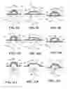 Fig. 13 - Methods and devices for applying closed incision negative pressure wound therapy
