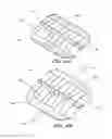 Fig. 17 - Methods and devices for applying closed incision negative pressure wound therapy