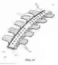 Fig. 20 - Methods and devices for applying closed incision negative pressure wound therapy