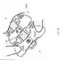 Fig. 49 - Methods and devices for applying closed incision negative pressure wound therapy