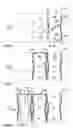 Fig. 04 - Method for forming a wrapping sheet having improved sealing